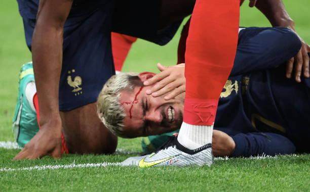 1687232305708055093.jpg 1499840228-612x612.jpg